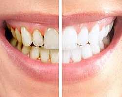 Espátula 36 odontologia Espátula 36 odontologia