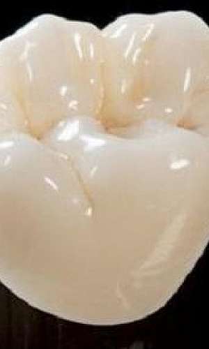 Cerâmica odontológica Cerâmica odontológica